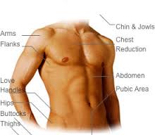 male lipo2