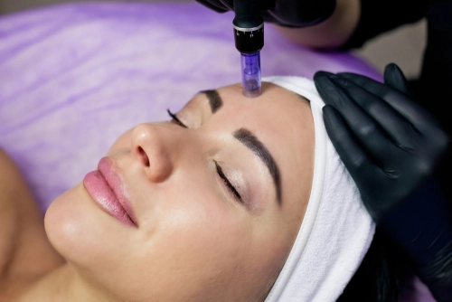 Patient receiving SkinPen Microneedling treatment