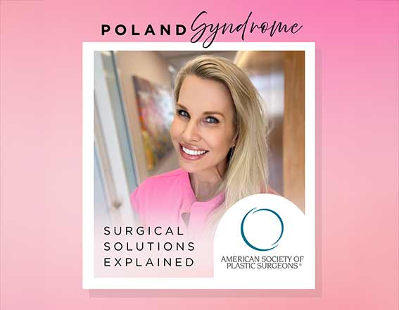 poland syndrome blog post thumbnail featuring karen horton