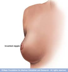 dr karen horton breast specialist san francisco