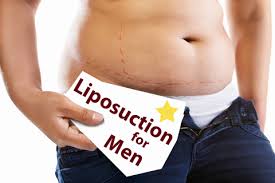 male lipo6