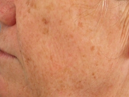 medium (4)