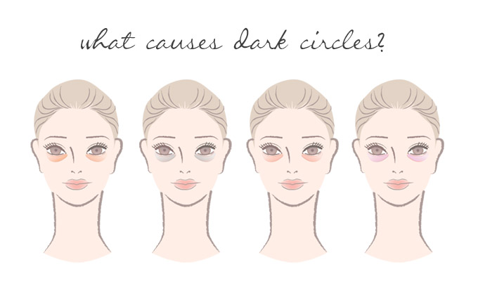 what-causes-dark-circles