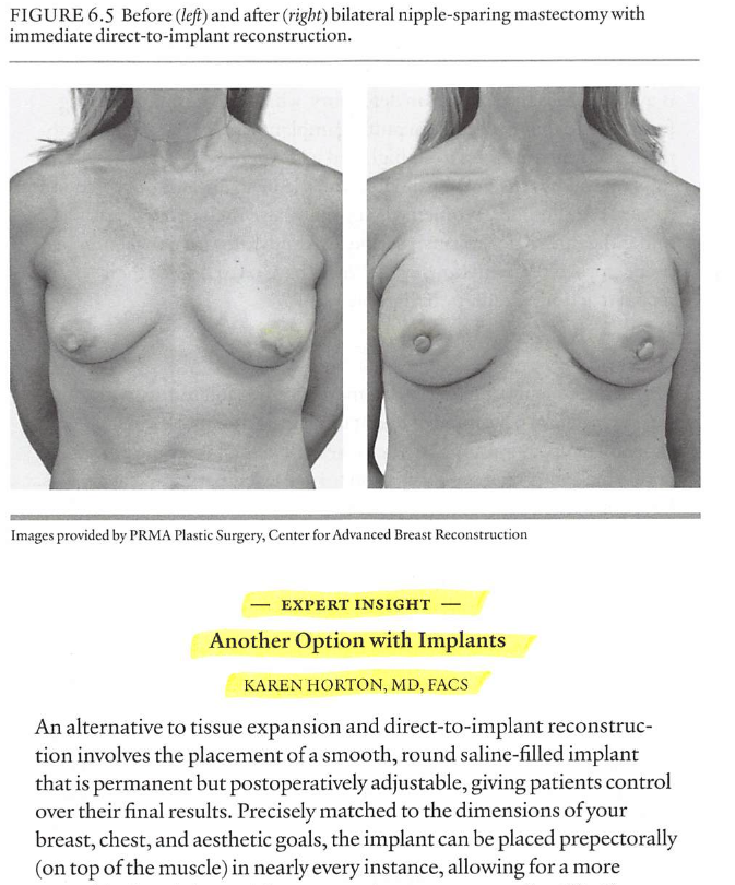 in the media The Complete Guide to Breast Reconstruction: Choosing the Best Options After Your Mastectomy