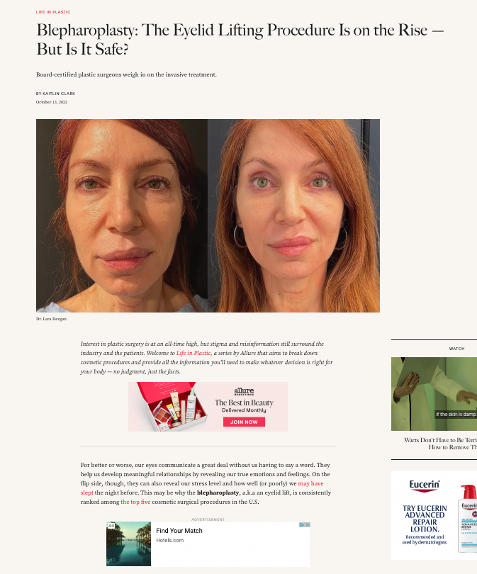 in the media Dr. Horton Featured in Allure Magazine Article on Blepharoplasty (Eyelid Lift)