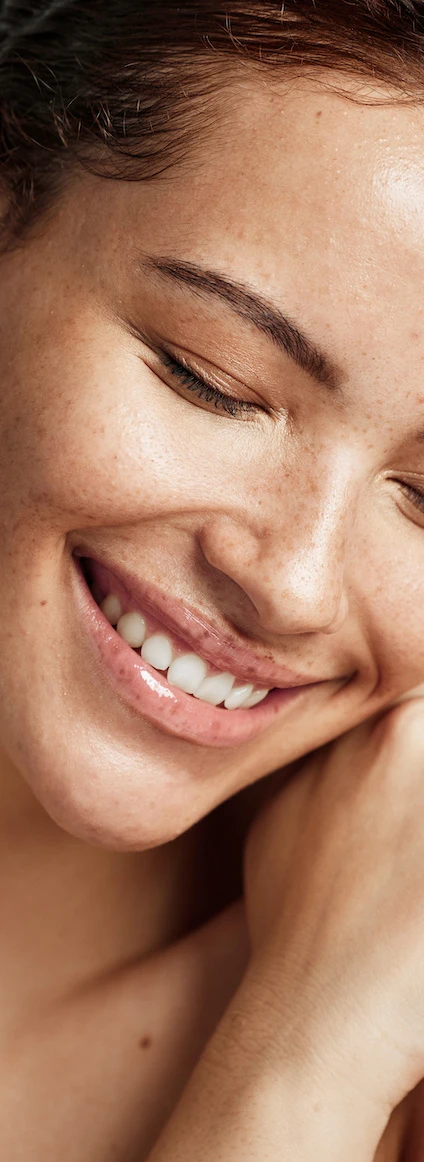 woman with beautiful smile after botox lip flip