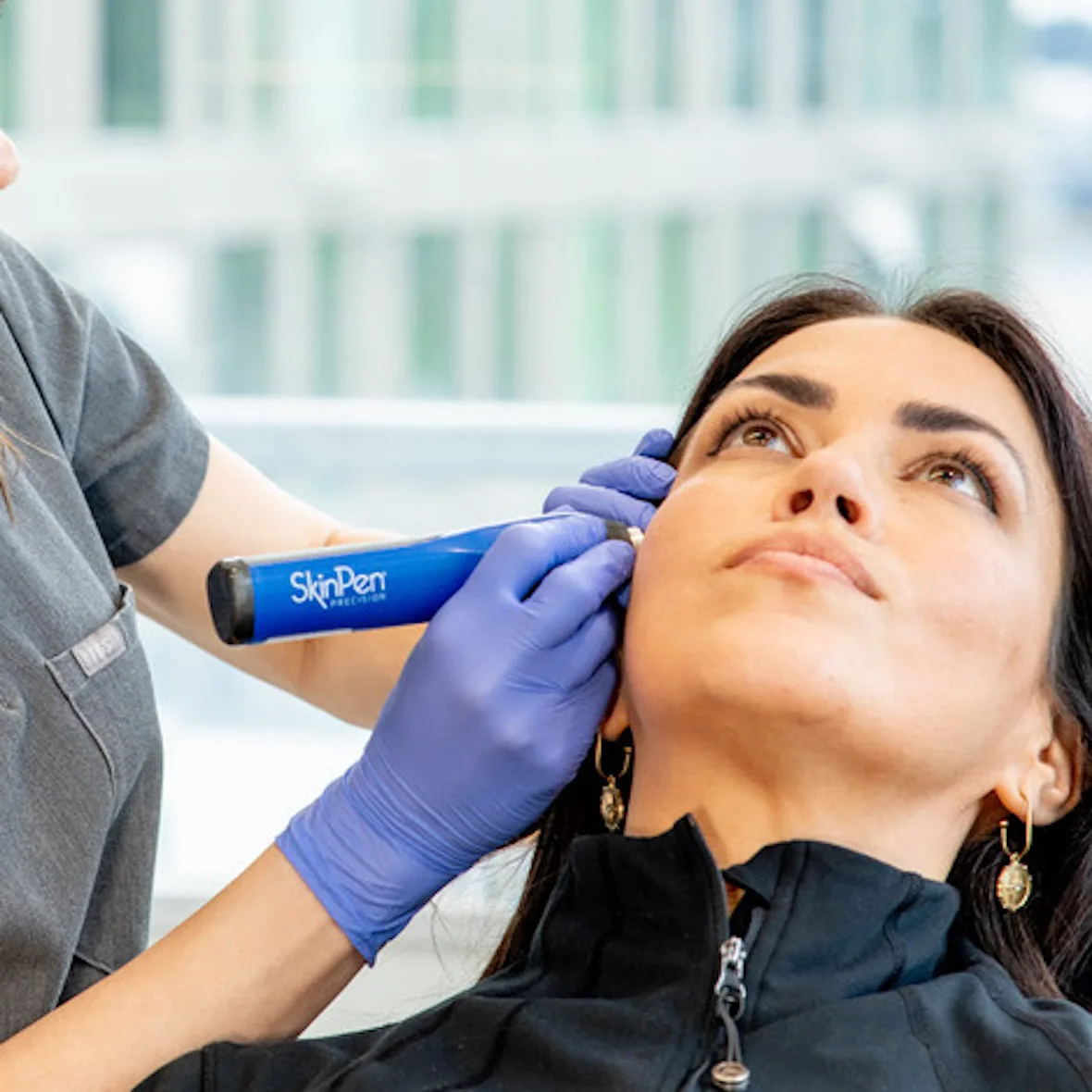 skinpen microneedling session
