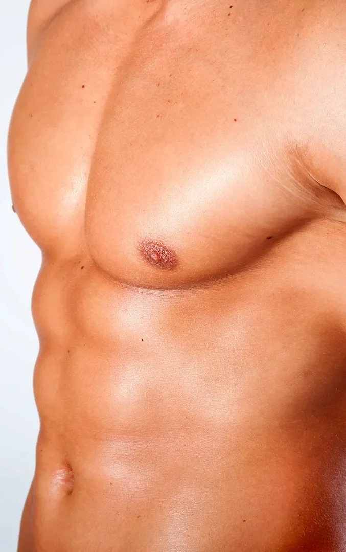 toned man after gynecomastia correction