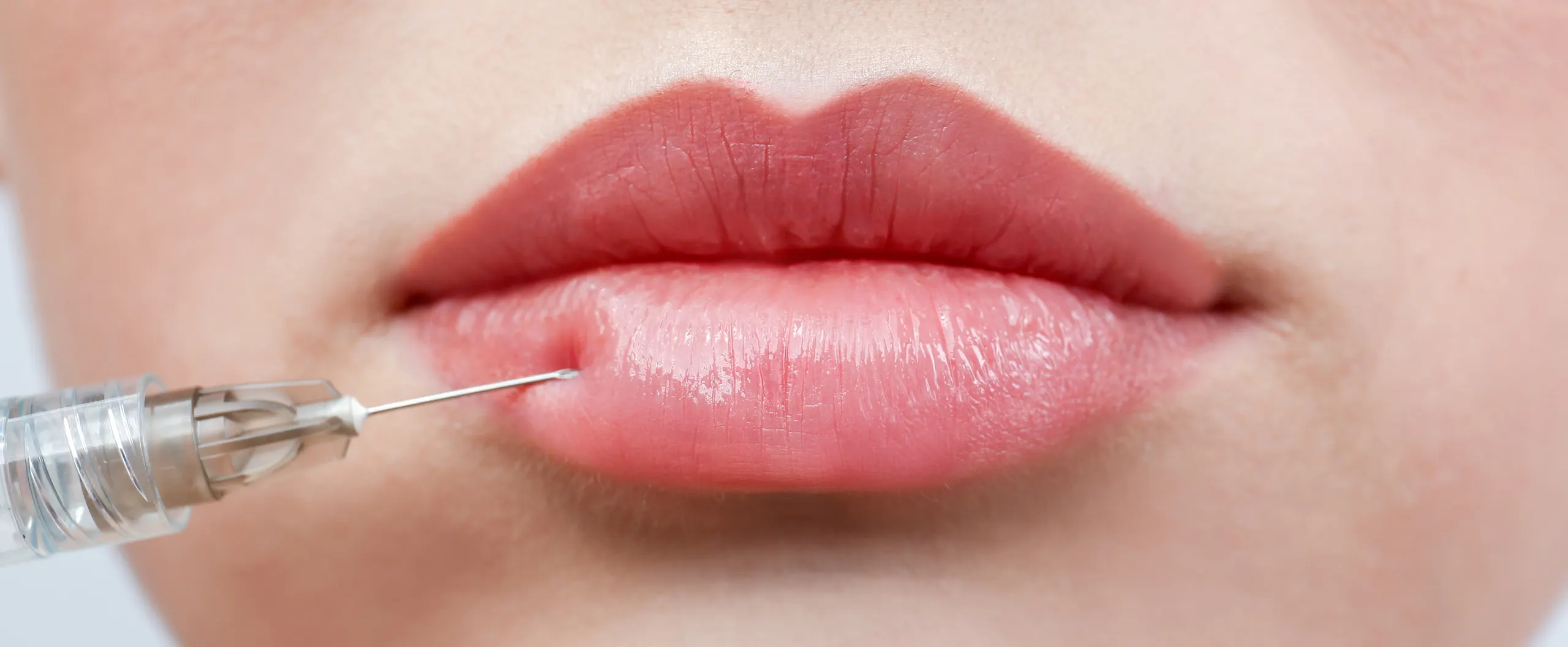 filled lips up close with needle