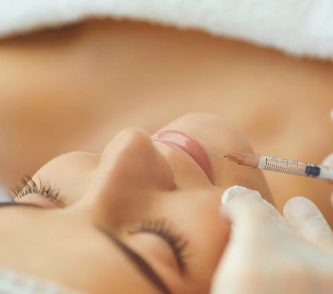 lip filler procedure for fuller hydrated lips