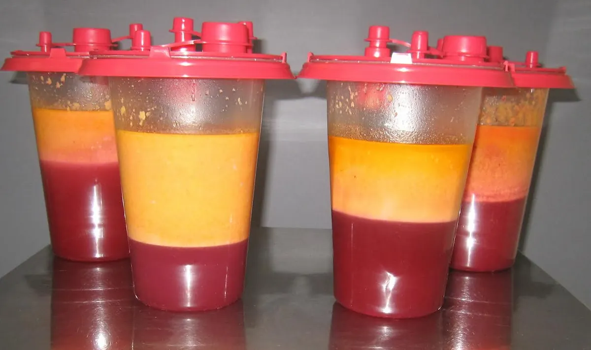Liposuction canisters filled with fat after a cosmetic liposuction case