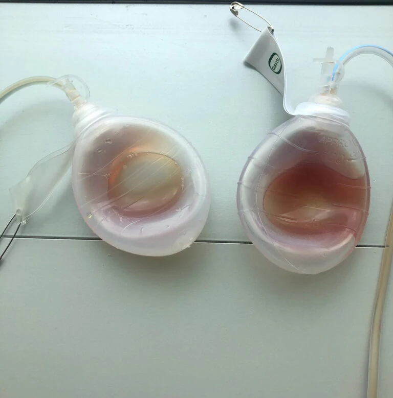 surgical drains