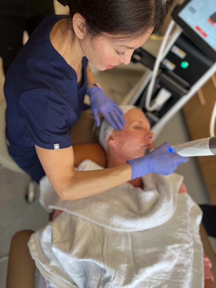 Dr. Horton receiving XERF treatment at San Francisco Plastic Surgery