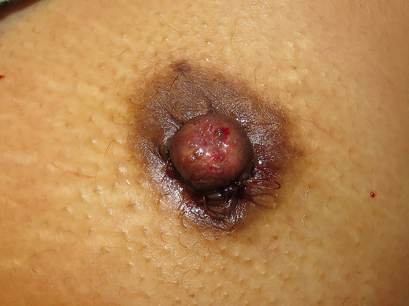 bna image
